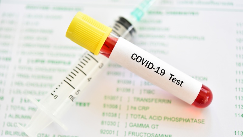 Oficial din Marea Britanie: vaccinările anuale anti-Covid-19 posibil să dea rezultate împotriva noilor variante de Covid
