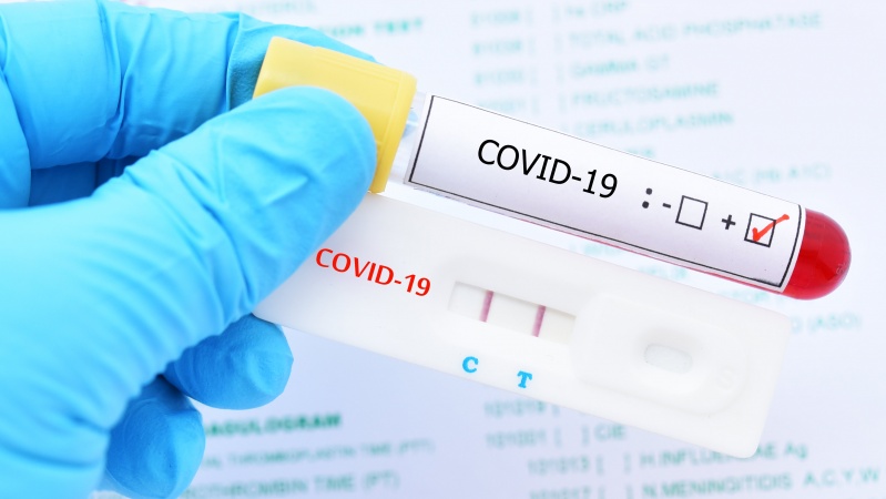 Covid: Testele anticorp oferite publicului pentru prima dată