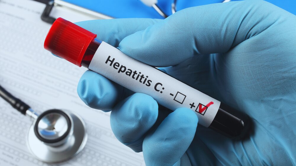 Sânge contaminat în UK: oamenii cumpără teste pentru hepatita C
