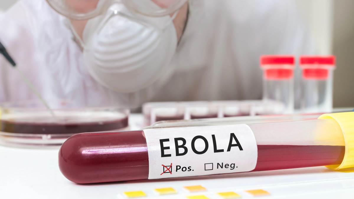 Muncitor britanic, evacuat la un spital din Londra după ce ar fi fost „expus” la Ebola